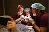Haartransplantatie in Turkije
