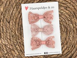 Haarstrik Flo setje 27 - set van drie strikken - kant - alligatorclip - roze/lila/roze