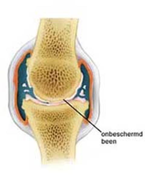 Grote foto voor de gewrichten van uw paard glucohorse dieren en toebehoren overige dieren