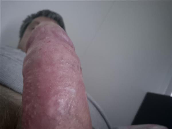 Grote foto sta je droog en heb je snel behoefte aan sex . erotiek man zoekt vrouwelijke sekspartner