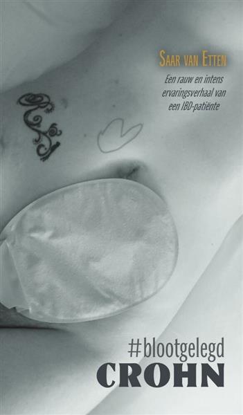 Grote foto crohn blootgelegd boeken hobby en vrije tijd