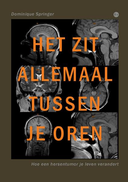Grote foto het zit allemaal tussen je oren boeken hobby en vrije tijd
