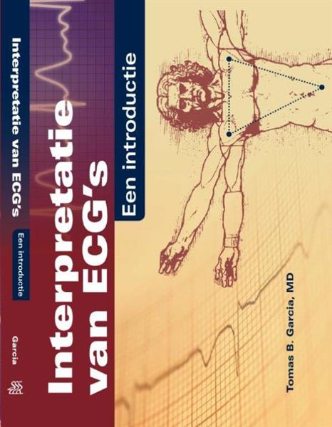 Grote foto interpretatie van ecg boeken wetenschap