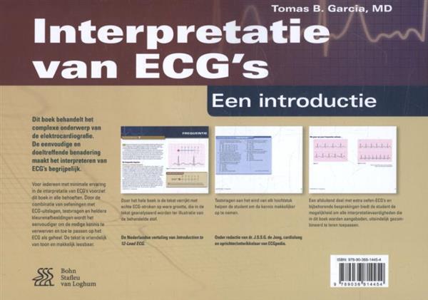 Grote foto interpretatie van ecg boeken wetenschap