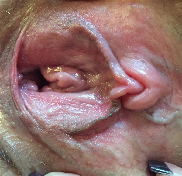 Grote foto zin in een bondageslet erotiek vrouw zoekt mannelijke sekspartner