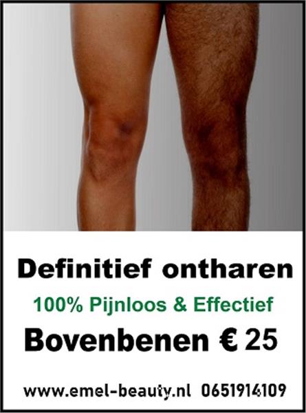 Grote foto laser ontharen hele lichaam 99 voor mannen beauty en gezondheid lichaamsverzorging