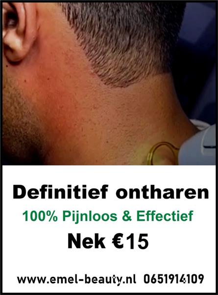 Grote foto laser ontharen full body 99 voor mannen beauty en gezondheid ontharing