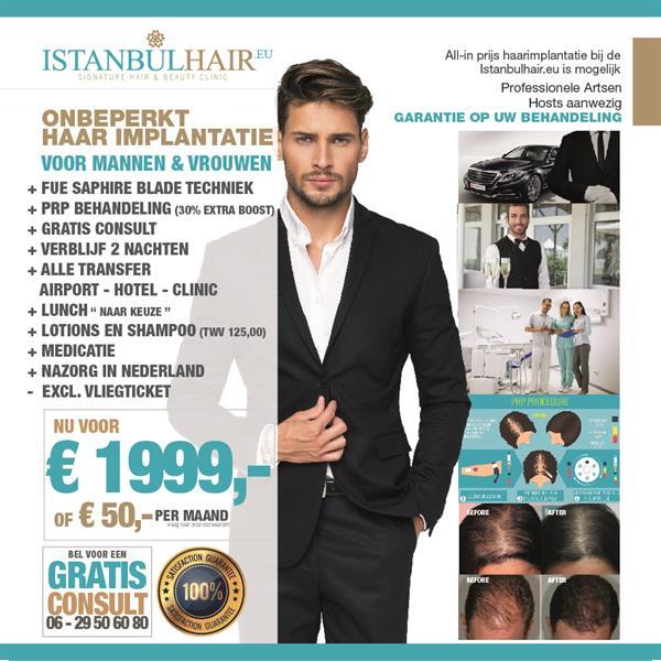 Grote foto istanbulhair.eu diensten en vakmensen haartransplantatie