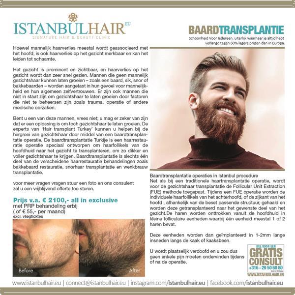 Grote foto istanbulhair.eu diensten en vakmensen haartransplantatie