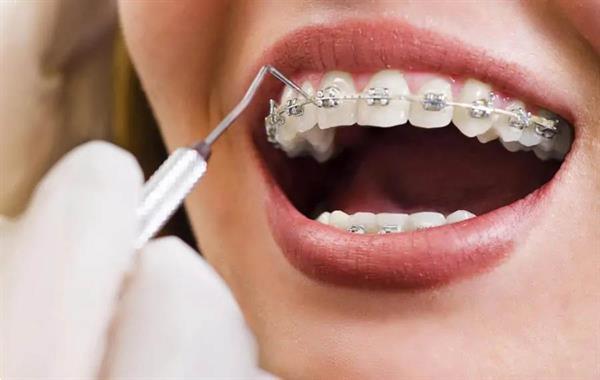Grote foto dentasey tandheelkundige vakantie in turkije diensten en vakmensen gebitsbehandelingen