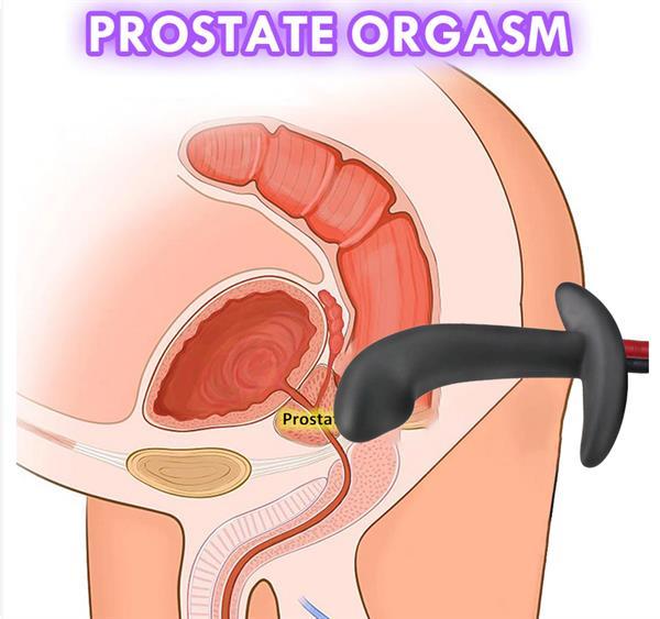 Grote foto electro shock anale plug voor koppels.1c erotiek sextoys