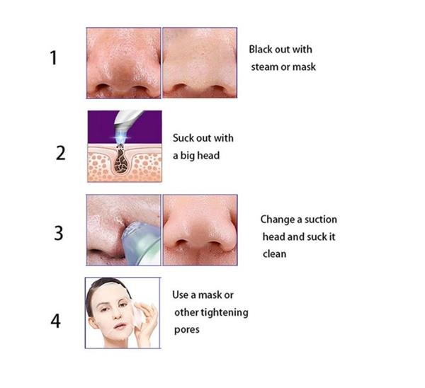 Grote foto blackhead remover acne puistjes mee eter verwijderen 2 kleuren huis en inrichting woningdecoratie